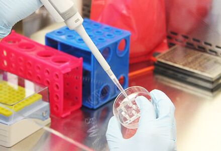 Ang pagsusi sa mga pagsulay sa pasyente sa wala pa ipahamtang ang augment sa Mammoplasty